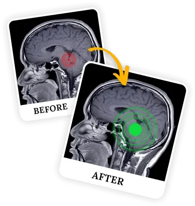 what is billionair brain wave program